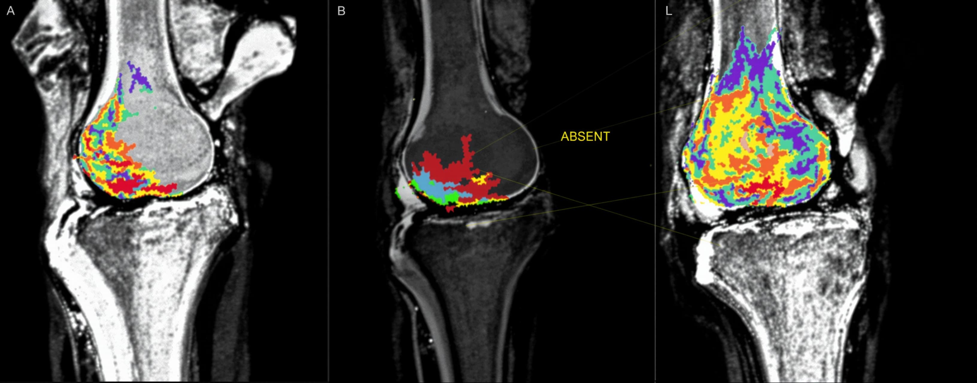 Knee MRI v1